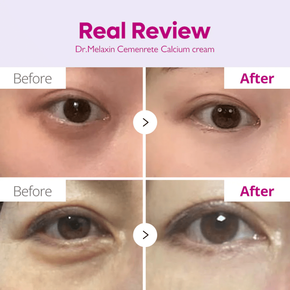 Dr.Melaxin Cemenrete Calcium Intense Cream (50ml) - UShops