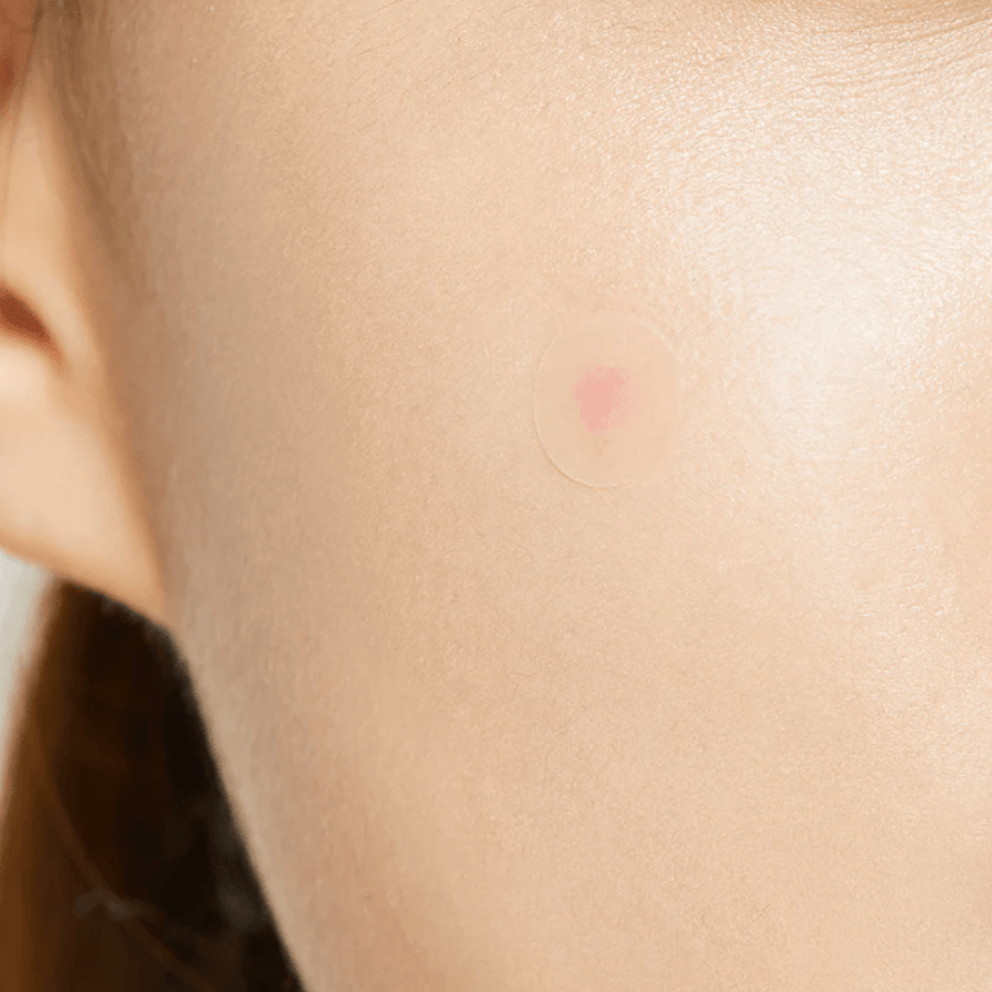 COSRX Acne Pimple Master Patch: Clear spot patches for acne. Keeps area clean and protected. Suitable for all skin types.