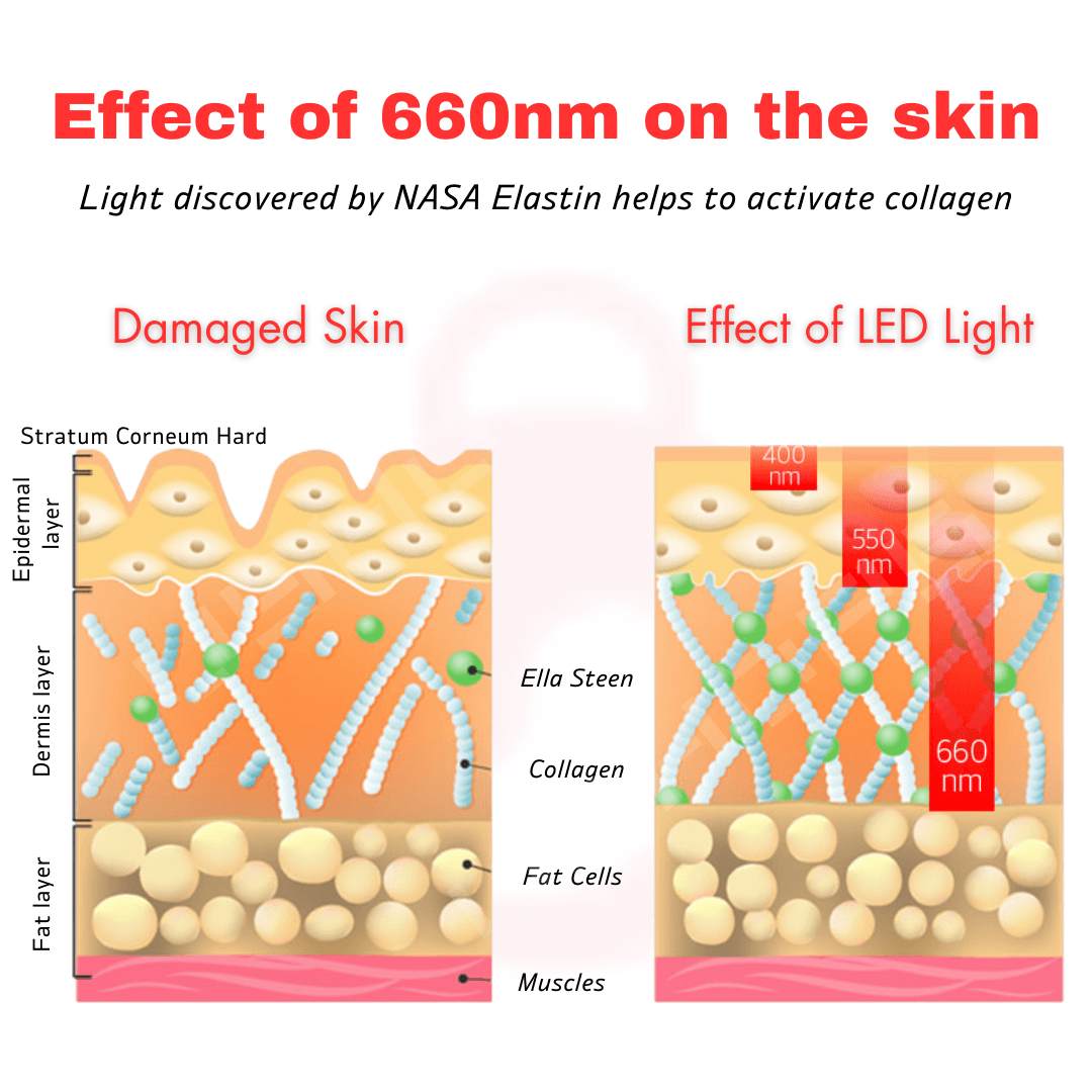 The YUFIT T: Laser LED Skin Rejuvenation Mask - UShops