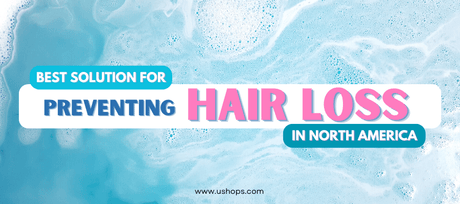 Best Solution For Preventing Hair Loss In North America - UShops