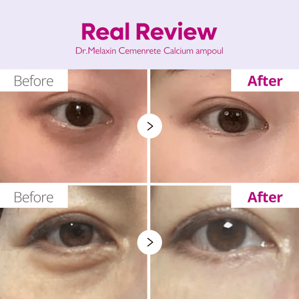 Dr.Melaxin Cemenrete Calcium Intense Ampoule (30ml) - UShops