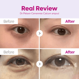 Dr.Melaxin Cemenrete Calcium Intense Ampoule (30ml) - UShops