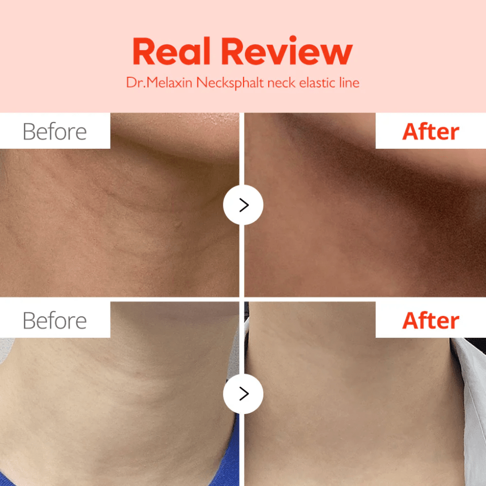 Dr.Melaxin Necksphalt ECM Neck Barrier Cream - UShops