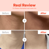 Dr.Melaxin Necksphalt ECM Neck Barrier Cream - UShops