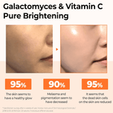 SOME BY MI Galactomyces Pure Vitamin C Glow Serum (30ml) - UShops